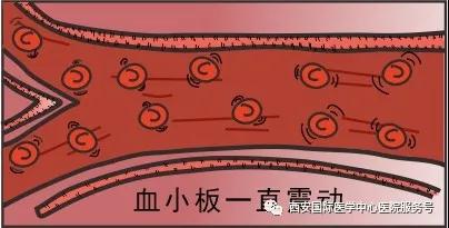 血小板是正常值的三倍？專家提醒小心血栓和出血！