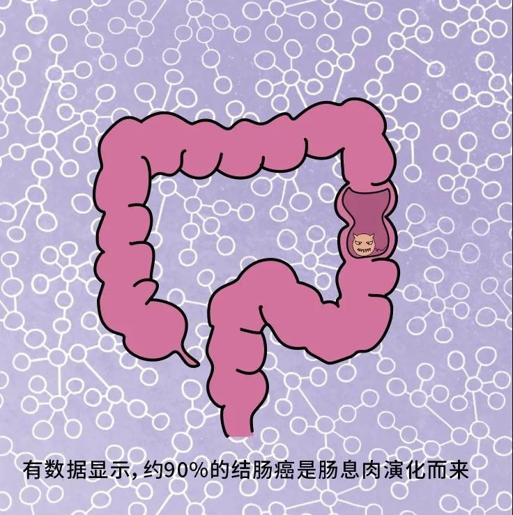 奪走“黑豹”生命的結(jié)腸癌，到底什么來(lái)頭？