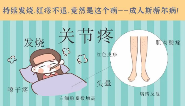 持續(xù)發(fā)燒、紅疹不退……她終于在這里治好了這個罕見病