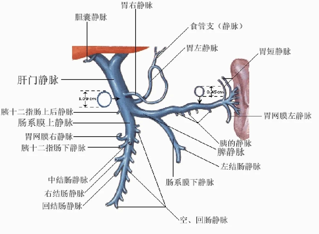 反復(fù)嘔血、黑便怎么辦？TIPS手術(shù)能解決