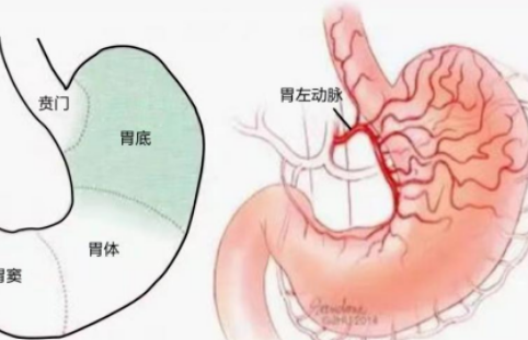 不開刀不吃藥不餓肚子，微創(chuàng)介入減肥靠譜嗎？
