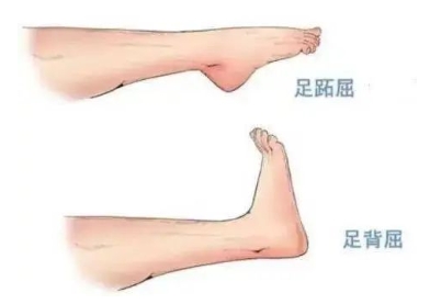 扭胯小連步、動(dòng)感搖花手……“科目三”雖火，運(yùn)動(dòng)損傷也要防！